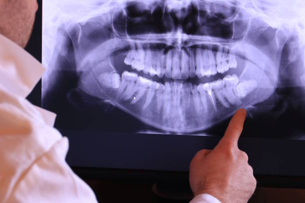 Best Emergency Treatment for Dental Infections or Abscesses in Rancho Alegre, TX